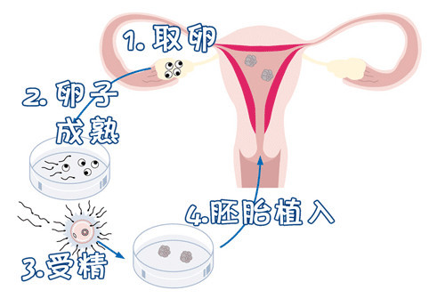 锦书生殖